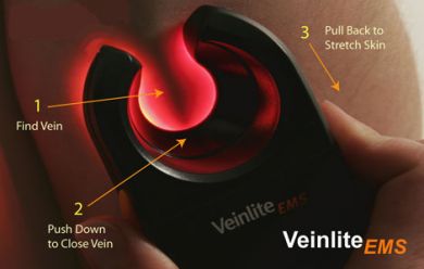 Veinlite EMS